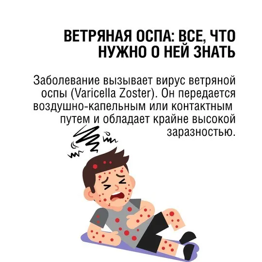 Ветряная оспа